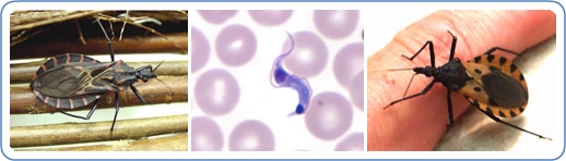 image chagas1