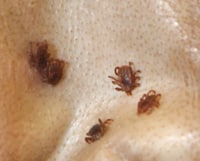Ticks